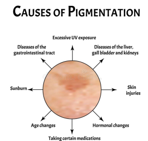 Reason for face pigmentation